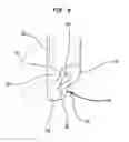Fig. 09 - Interlocking Zipper Pull Tabs and Fastening System