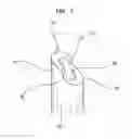 Fig. 08 - Interlocking zipper pull tabs and fastening system