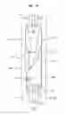 Fig. 18 - Interlocking zipper pull tabs and fastening system