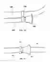 Fig. 09 - Devices, systems, and methods for combining mobility and reaching aids