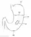 Fig. 01 - CAPSULE MEDICAL DEVICE GUIDE SYSTEM