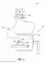 Fig. 02 - Method and apparatus for tracking in a medical procedure