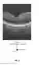 Fig. 06 - Optical coherence tomography (OCT) system with phase-sensitive B-scan registration