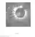 Fig. 07 - Methods for stent strut detection and related measurement and display using optical coherence tomography
