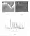 Fig. 09 - Methods for stent strut detection and related measurement and display using optical coherence tomography