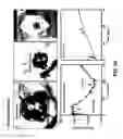 Fig. 41 - IMPLANTABLE AND BIORESORBABLE SENSORS