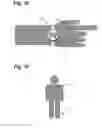 Fig. 06 - MOTION COMPENSATED BIOMEDICAL SENSING