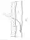 Fig. 08 - Suture-based closure with hemostatic tract plug