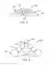 Fig. 04 - FISTULA TREATMENT DEVICES AND METHODS