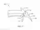 Fig. 08 - FISTULA TREATMENT DEVICES AND METHODS