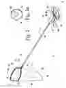Fig. 02 - Surgical tissue retrieval instrument and method of use of a surgical tissue retrieval instrument