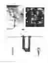 Fig. 03 - Tissue clip