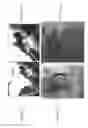 Fig. 09 - Tissue clip