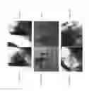 Fig. 10 - Tissue clip