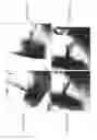 Fig. 14 - Tissue clip