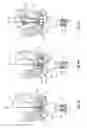 Fig. 13 - NEEDLE REMOVAL DEVICES, SYSTEMS, AND METHODS