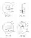 Fig. 131 - Systems and methods for increased operating room efficiency