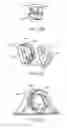 Fig. 83 - Systems and methods for increased operating room efficiency