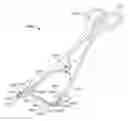 Fig. 01 - Skin straining devices and methods