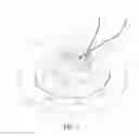 Fig. 22 - Anvil assembly and anvil assembly delivery system