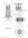 Fig. 16 - Apparatus and methods for introducing portals in bone