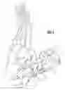 Fig. 02 - Surgical jig assembly for use in the manipulation and fixation of bony structures