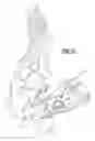 Fig. 14 - Surgical jig assembly for use in the manipulation and fixation of bony structures