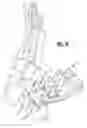 Fig. 15 - Surgical jig assembly for use in the manipulation and fixation of bony structures