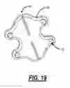 Fig. 16 - Surgical jig assembly for use in the manipulation and fixation of bony structures