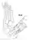 Fig. 17 - Surgical jig assembly for use in the manipulation and fixation of bony structures