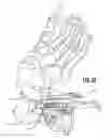 Fig. 23 - Surgical jig assembly for use in the manipulation and fixation of bony structures