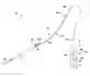 Fig. 01 - Tissue-removing catheter including movable distal tip