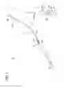 Fig. 02 - Tissue-removing catheter including movable distal tip