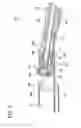 Fig. 03 - Tissue-removing catheter including movable distal tip
