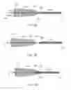 Fig. 03 - Flexible intravascular treatment devices and associated systems and methods of use