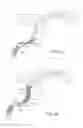 Fig. 09 - Flexible intravascular treatment devices and associated systems and methods of use