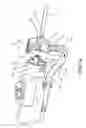 Fig. 05 - Surgical drive apparatus