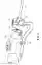 Fig. 07 - Surgical drive apparatus