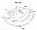 Fig. 12 - Motor control and feedback in powered surgical devices
