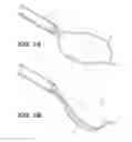 Fig. 02 - Devices for manipulating tissue and related methods