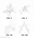 Fig. 03 - Devices for manipulating tissue and related methods