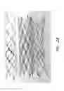 Fig. 43 - Expandable tip assembly for thrombus management