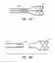 Fig. 71 - Expandable tip assembly for thrombus management