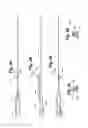 Fig. 12 - Catheter System for Left Heart Access