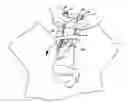 Fig. 01 - Device for treating shoulder dystocia