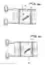 Fig. 04 - Device for treating shoulder dystocia