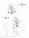 Fig. 10 - Device for treating shoulder dystocia