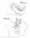 Fig. 11 - Device for treating shoulder dystocia