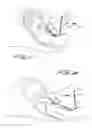 Fig. 12 - Device for treating shoulder dystocia