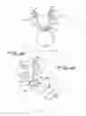 Fig. 15 - Device for treating shoulder dystocia